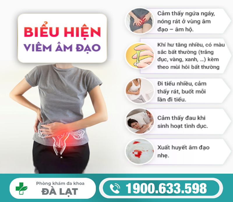 Hình ảnh minh họa